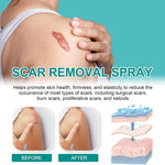 ScarRemove+ Advanced Spray Fade Scars